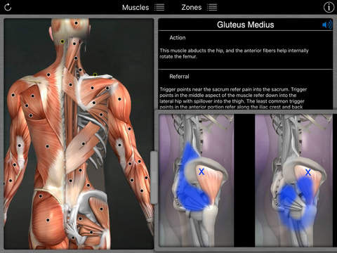Muscle Trigger Points for iPhone & iPad
