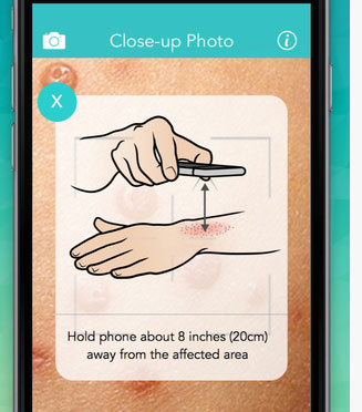 First Derm for iPhone: Ask the Dermatologist