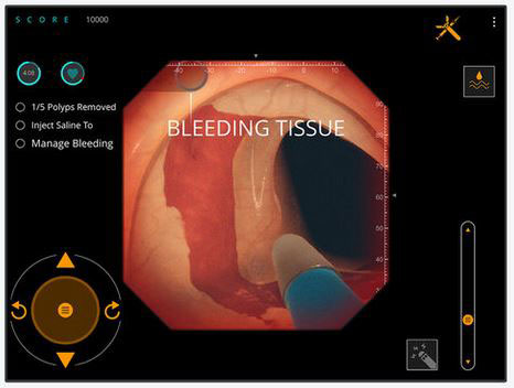 Gastro Ex Surgery App for iPhone & iPad